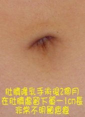 腋下「無疤」以示真奶？無事實依據的爆料成了家常菜？_圖2