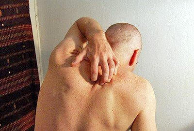 入秋預防皮膚乾癢,首重「養肺陰」