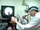 鼻病新利器---鼻腔內視鏡