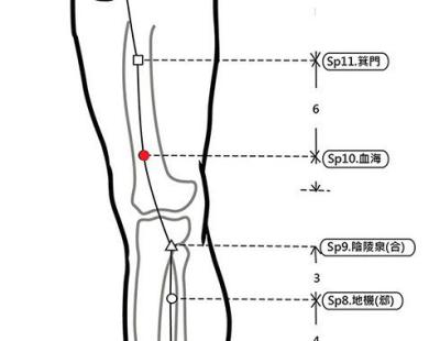 穴位保健─血海穴（消除濕癢與保健美人穴）