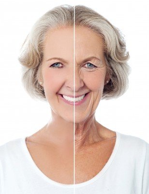 5種醫美療法Hold住膠原蛋白，找回青春肌膚_圖2