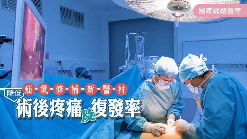 疝氣修補新醫材，降低術後疼痛及復發率_圖1