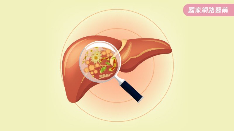 C型肝炎知多少？_圖4