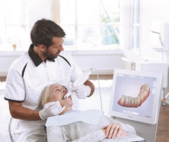 口內掃描機，輕鬆做假牙_圖3