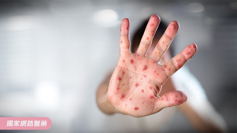 免憂腸病毒肆虐 ! 如何作好消毒與滅菌防護_圖2