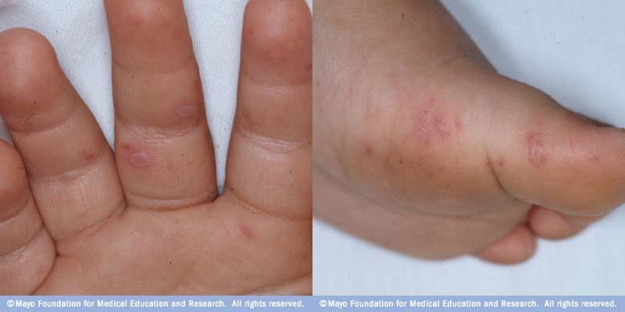 免憂腸病毒肆虐 ! 如何作好消毒與滅菌防護_圖3