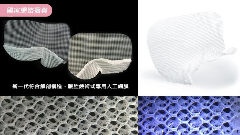 疝氣手術的治療與新型人工網膜的應用_圖2