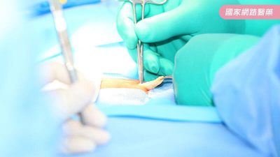 腹腔鏡疝氣手術進入新型態人工網膜時代