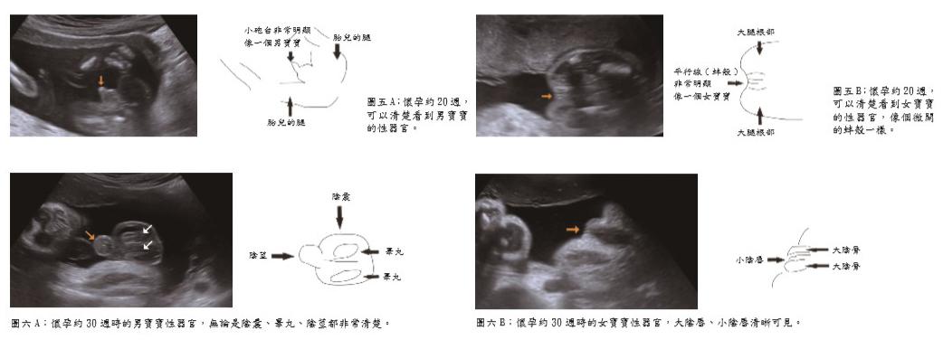 超音波看胎兒性別的真相_圖3