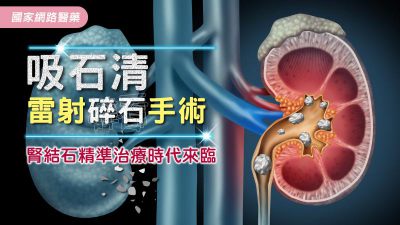 腎結石精準治療 吸石清雷射碎石手術