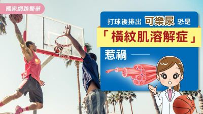 打球後排出可樂尿 恐是「橫紋肌溶解症」惹禍