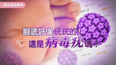 腳底好像疣疣的！這是病毒疣嗎？