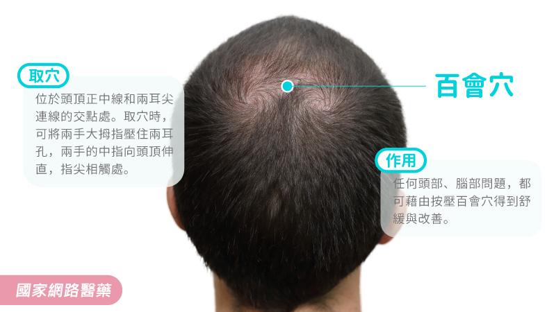 預防季節掉髮，中醫有辦法！_圖3