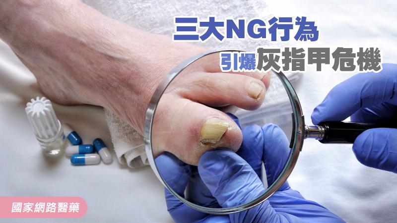 三大NG行為 引爆灰指甲危機_圖1