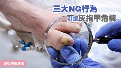 三大NG行為 引爆灰指甲危機