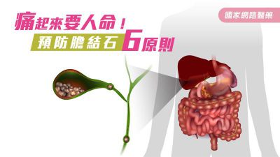 痛起來要人命！預防膽結石6原則