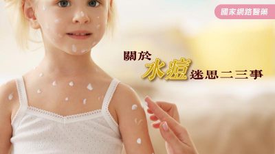 關於水痘迷思二三事