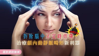 拆除腦中不定時炸彈 治療顱內動靜脈畸形新利器