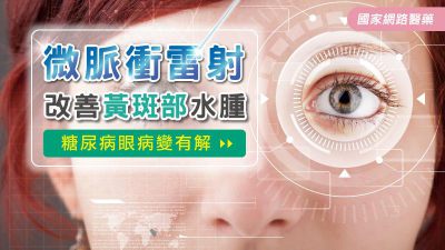 糖尿病眼病變有解 微脈衝雷射改善黃斑部水腫