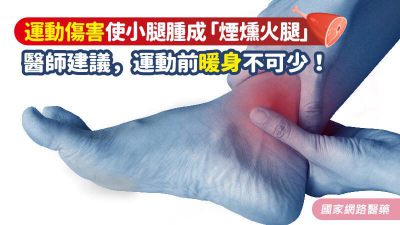 運動傷害使小腿腫成「煙燻火腿」？醫師建議，運動前暖身不可少！