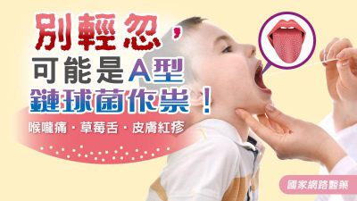 喉嚨痛•草莓舌•皮膚紅疹 別輕忽！可能是A型鏈球菌作祟