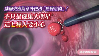 威爾史密斯意外檢出「癌變息肉」！不只是健康大明星，這七種人要小心