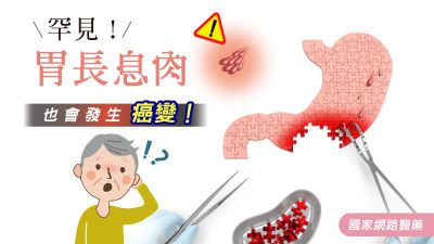 罕見！胃長息肉也會發生癌變！