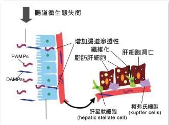 非酒精性脂肪肝疾病致病機制的探討〜著重於腸道菌群所扮演的角色_圖2 非酒精性脂肪肝疾病致病機制的探討〜著重於腸道菌群所扮演的角色_圖2