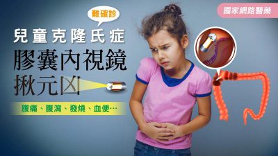 兒童克隆氏症難確診 膠囊內視鏡揪元凶