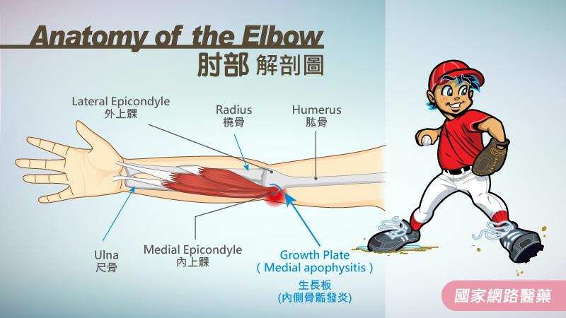 摧殘棒球夢的少棒肘_圖3