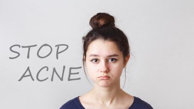 痘痘反覆發作好不了？皮膚科醫師 : 多管齊下提高痘痘治療效果！