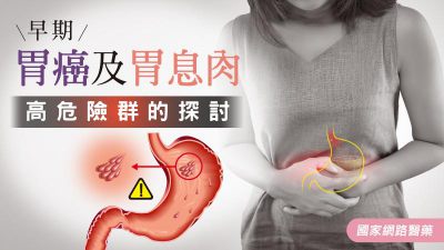 早期胃癌及胃息肉高危險群的探討