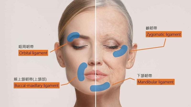 老化鬆弛韌帶失去支撐力　皮膚專科醫師談韌帶拉提注射_圖2