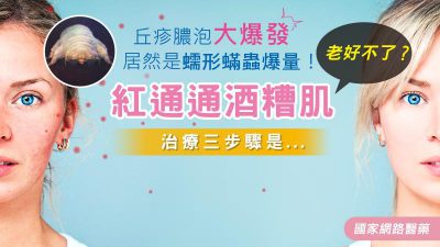 紅通通酒糟肌老好不了？治療三步驟是... 