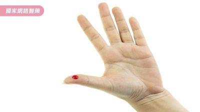 【道聽不塗說】抽穴道的血？就是俗稱的「放血」？！