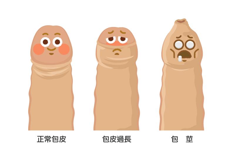 錯誤迷思導正！割包皮會讓小弟弟變「迷你雞」？_圖2