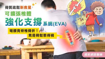 彎腰竟脊椎骨折！竟是骨鬆惹禍 骨質疏鬆新救星：可擴張椎體強化支撐系統(EVA)