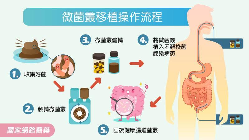 糞便也能救人！致命困難梭菌感染 可用微菌叢植入治療_圖2