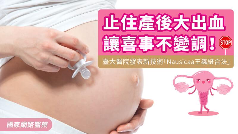 止住產後大出血，讓喜事不變調！臺大醫院發表新技術「Nausicaa王蟲縫合法」