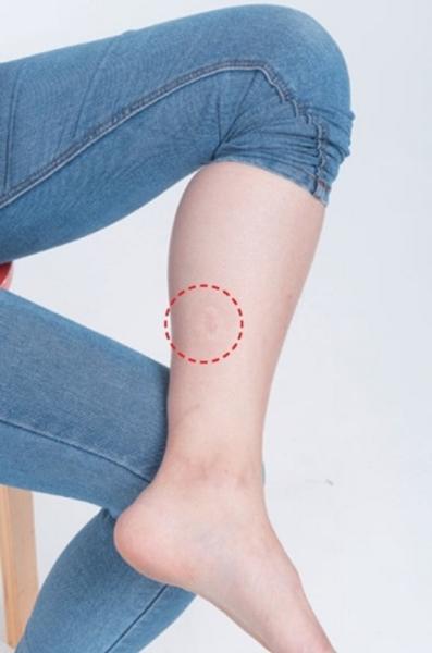 受傷、手術後...要做「疤痕按摩」防止筋膜沾黏！醫師教你3招預防_圖2