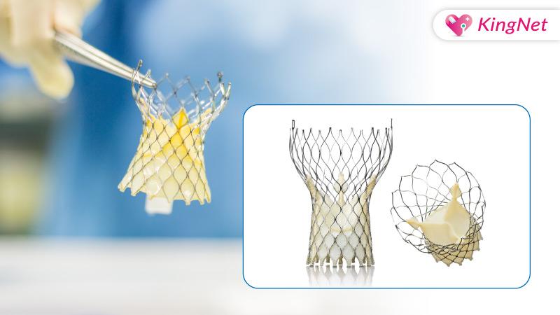 主動脈瓣膜年久失修恐致命！經導管主動脈瓣置換手術為長者續命_圖3
