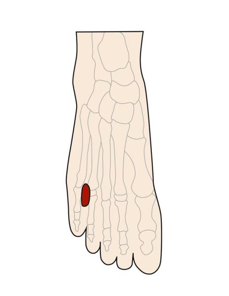 「沉默殺手」高血壓，台灣每4人就有1人！中醫診所院長教你，在家用這方法就可降血壓_圖6