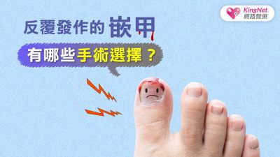 反覆發作的嵌甲 有哪些手術選擇？