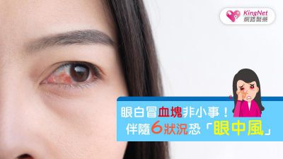 眼白冒血塊非小事！伴隨6狀況恐「眼中風」