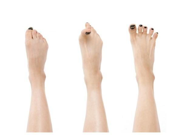 你的腳痛是會麻還是會腫？小心已經「長瘤」！疼痛醫學專家揭：「腳痛」代表的3種疾病警訊_圖2