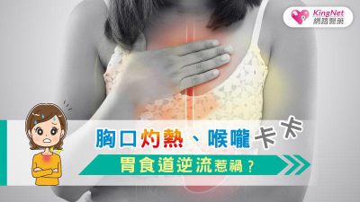 胸口灼熱、喉嚨卡卡，胃食道逆流惹禍？