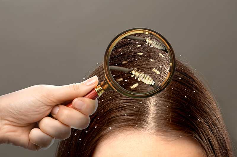 夢中的蝨子：危機中的財富的夢境示意圖