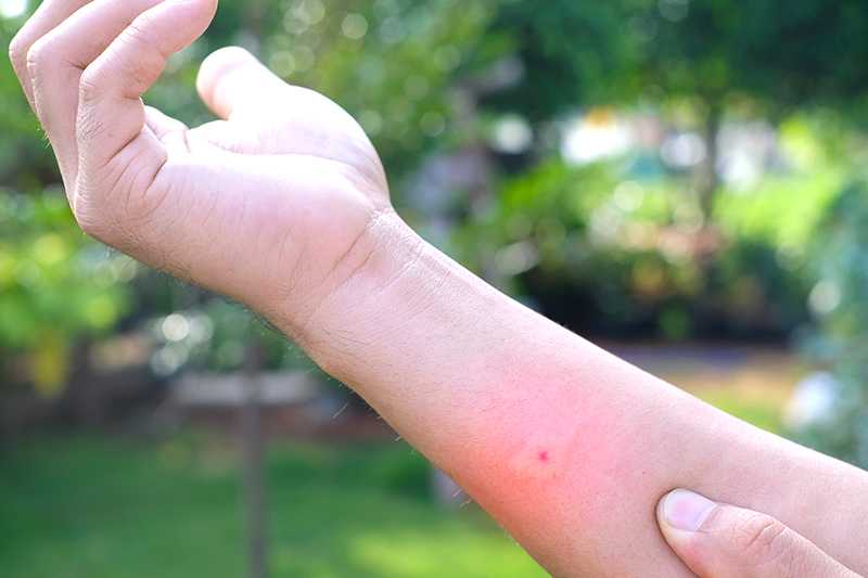 夢見被蜜蜂螫：有益的朋友的夢境示意圖