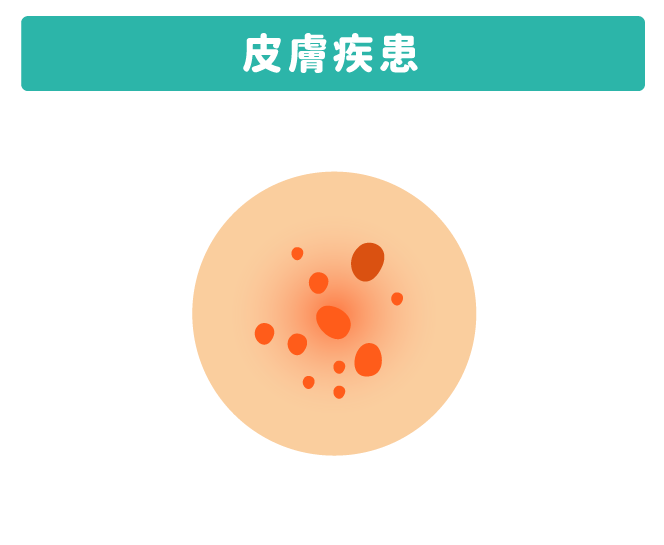 皮膚疾患
