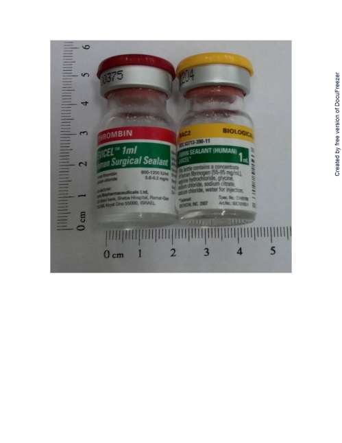 EVICEL Fibrin Sealant 愛微止纖維蛋白凝合劑組(1)